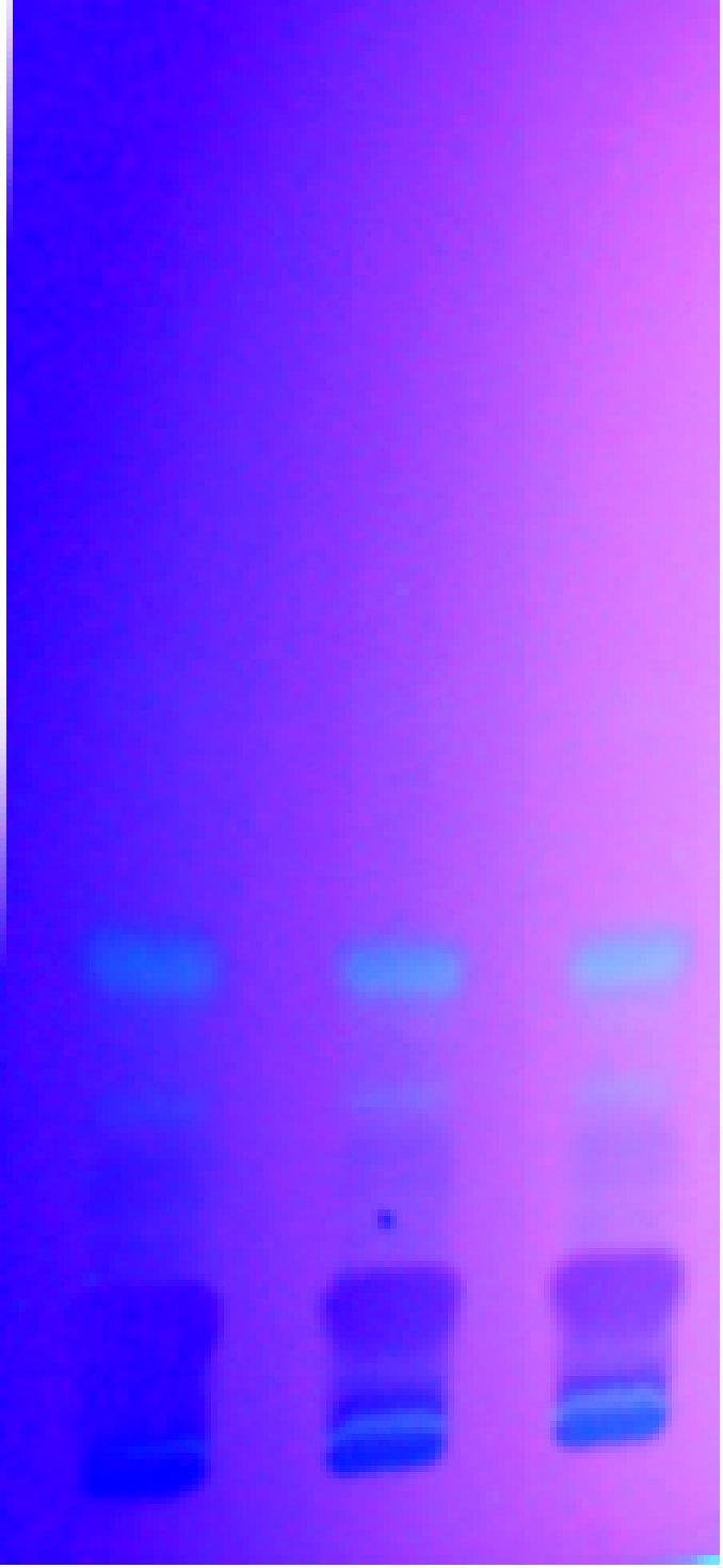Figure 5: 3D view of methanolic extract at 254 nm (A) and 366 nm (B) (A) (B) Figure 6: Chromatogram of methanolic extract at 254 nm (A) and