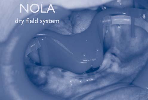 NOLA Dry Field System for Implant Surgery - continued from front of cross contamination or time for cold