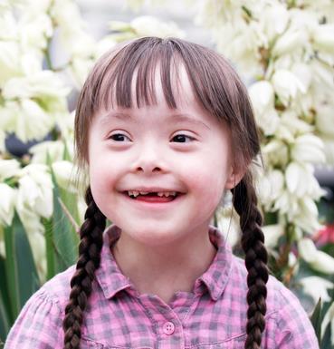 Down s syndrome Poor sleep - reduced REM sleep and increased slow-wave sleep independent of OSA - implications for learning, memory, and behavior Anatomy : maxillary