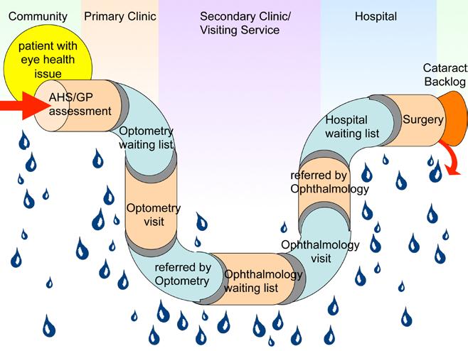 The Patient Journey Successful eye health outcomes involve co-ordination of both eye care services and the patient journey The referral pathway is a leaky pipe with a blockage at its end It is often