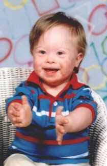 Mikey has Down s Syndrome. He has an extra chromosome.