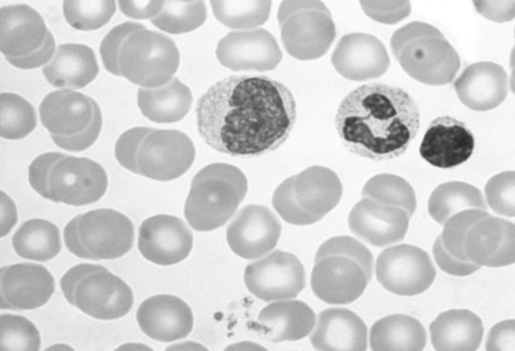 2 Fig. 2.1 is a photomicrograph of some blood cells. 8 phagocytes nuclei lymphocyte red blood cells magnification 1500 Fig. 2.1 (a) (i) State two visible differences between the red blood cells and the white blood cells (phagocytes and lymphocytes) in Fig.