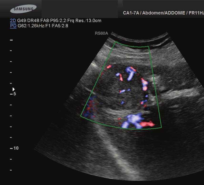 CEUS imaging in bdominal, Superficial and Vascular Study In the guidelines and recommendations proposed by European Federation of Societies for Ultrasound in