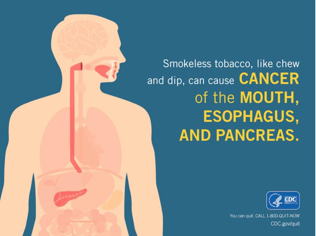 Smokeless Tobacco and Health Cancer Oral