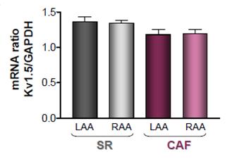 decreased only in the RAA, but remained unchanged in the LAA I sus density became