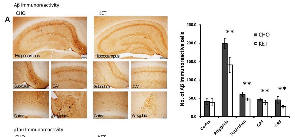 Neuroprotective Effect of Ketogenic Diet in Animal