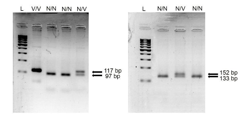 Detekcija ispitivanih genetičkih varijanti primenom metode PCR-RFLP.
