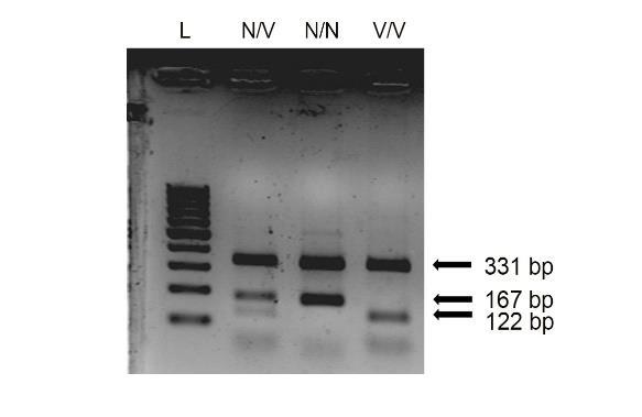 češćeg ( normalnog ) alela (N/N), heterozigotni nosilac (N/V) ili homozigotni