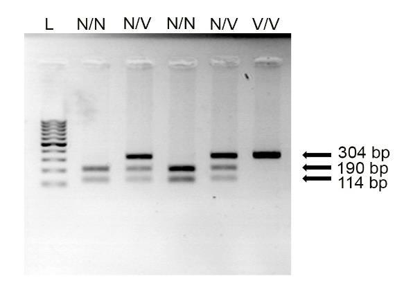 U slučaju IL-1RN, jedna PCR reakcija je bila dovoljna za detekciju A1/2/3 alela
