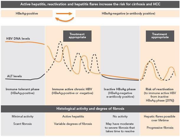 Fig 1: Natural history of chronic hepatitis B after infection in neonatal or childhood period Subsequent viral mutation in some individuals can lead to partial escape of immune control and