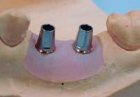 features considering gingiva height and interocclusal relationship.