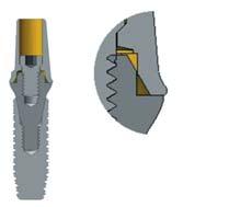 Abutment Transfer Type Pick-up Type When fabricating a screw type prothesis/combi type prosthesis with a hole on the occlusal surface a non-hexed type 2-piece abutment such as Transfer/GoldCast
