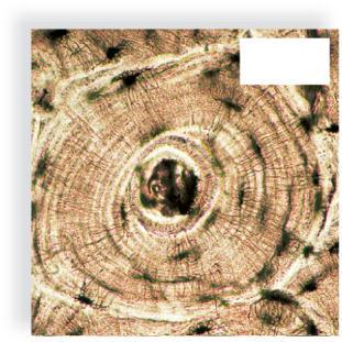Compact bone osteon s in lacunae in lacuna concentric lamellae 100 µm Blood vessels osteon Osteocyte canaliculus lacuna nucleus Cartilage Not as strong as bone but more flexible Matrix is gel-like