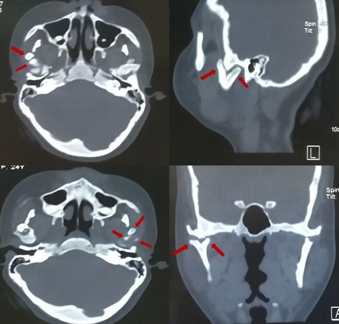Figure 3: Axial, sagittal & coronal sections of CT