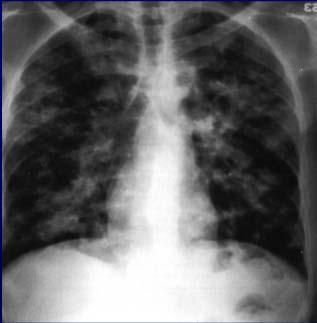 radiological appearance is