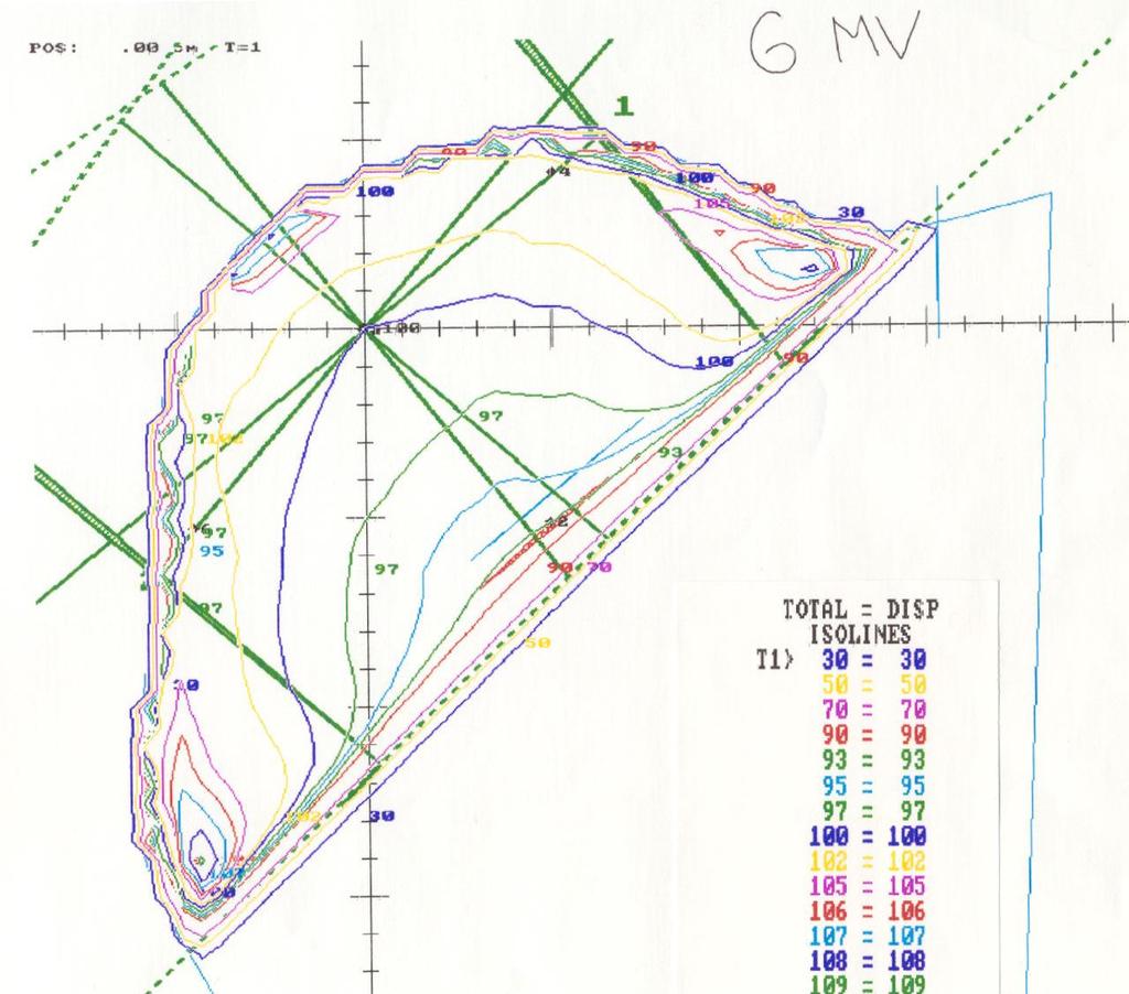 2D Planning 80-90 s Wedged Tangent Central axis contour.
