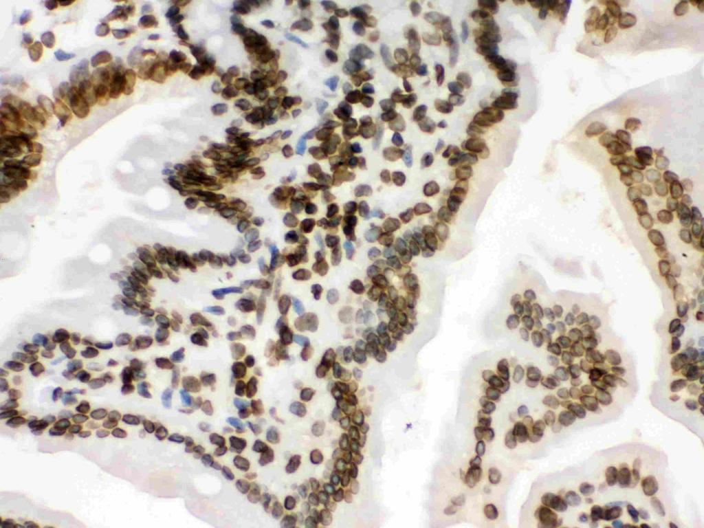 Mouse Intestine Tissue. Heat mediated antigen retrieval was for Figure 3.