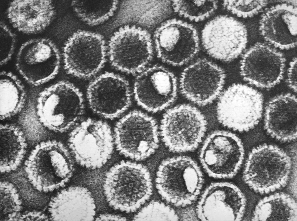Figure 4 Herpes simplex Virus Transmission Electron Microscopic This negatively-stained transmission electron microscopic (TEM) image revealed the presence of numerous herpes simplex virions.
