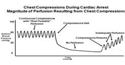 Compression Interruptions Resuscitatus interruptus Negatively impacts outcome Without compressions, no perfusion is occurring Airway management accounts for longest interruption Basic vs advanced