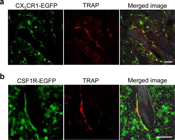 Supplementary Fig. 2. Differentiation of CX 3 CR1-EGFP + and CSF1R-EGFP + cells into TRAP + mature osteoclasts.