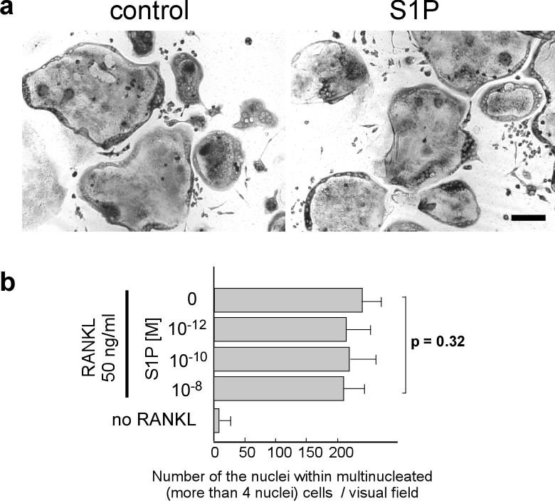 Supplementary Fig. 7. Absence of effects of S1P on RANKL-induced osteoclastogenesis in vitro. a, Representative images of osteoclast precursor RAW264.
