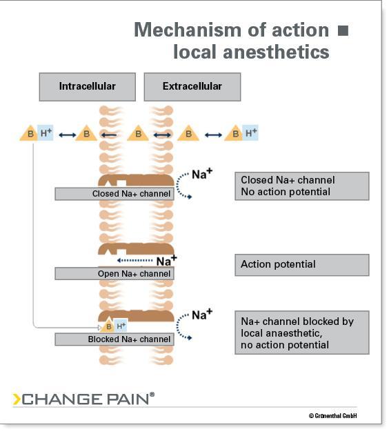 Nonopioids: local anesthetics Examples: lidocaine, bupivacaine, Lidoderm patch, Capsaicin cream Delivery: topical, SC, IV, perineural, epidural MOA: block Na channels,