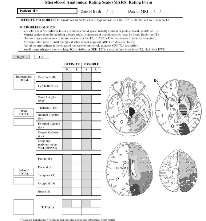 Neuroimaging Int J Stroke. 2015 Oct;10 Suppl A100:155-61.