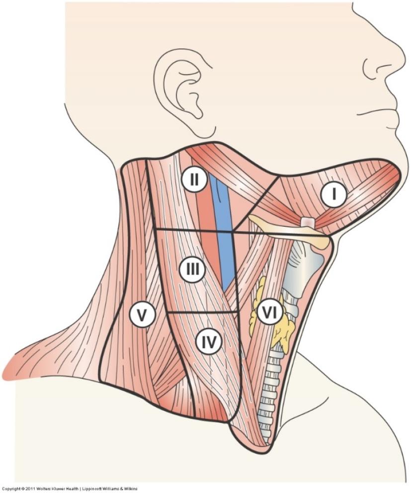 Clinically or biopsy positive nodes Central neck (level VI) Lateral neck (levels II, III, IV, Vb) If