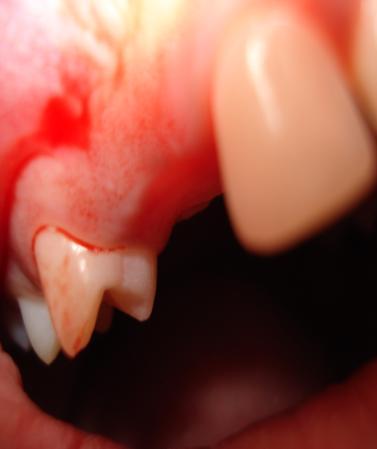 periodontal ligament.