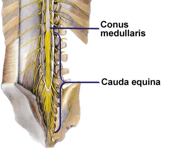 The tapered inferior end forms conus medullaris.