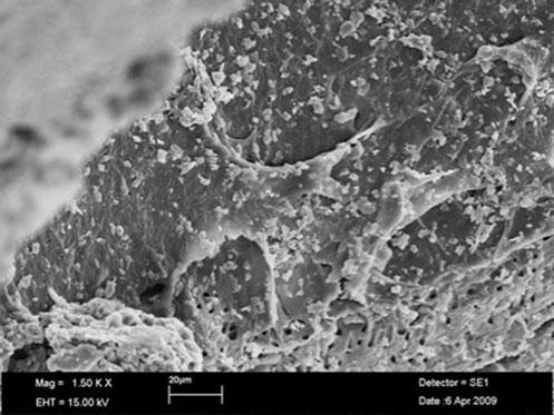 82 Lasers Med Sci (2013) 28:79 85 Discussion Fig. 1 SEM image of a 3 day-old biofilm on a root canal.