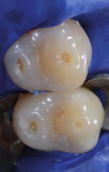 It is importnt to recll tht this suject does not hve simple methodologicl pproch involving specific restortion techniques.