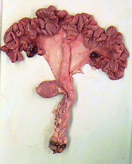 Porcine Reproductive Anatomy Uterine Horn Uterine
