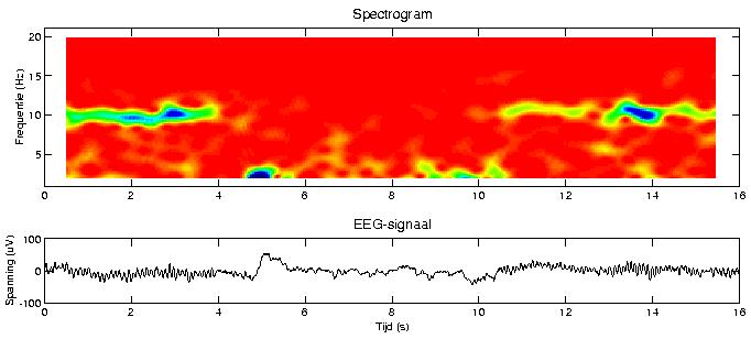 EEG and MEG: Task-related changes in cortical oscillations Noticed by Berger - not assigned much
