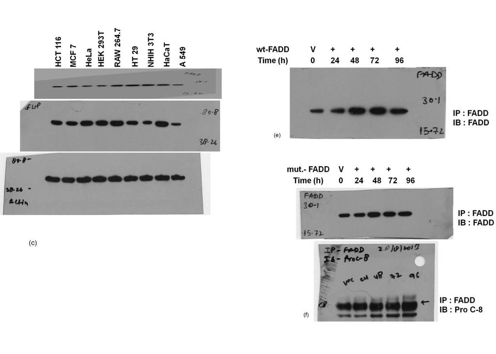 29 30 31 Figure S2. The uncropped full-length image of western blot results for Figure 1c, e & f.