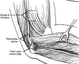 at wrist 1st rib syndrome Treatment Rest, avoid elbow flexion ADLs Night splinting in elbow flex < 30 deg 4-6 weeks Cubital Tunnel Syndrome Special Tests