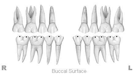Cast-Radiograph Evaluation Occlusal Contacts 5