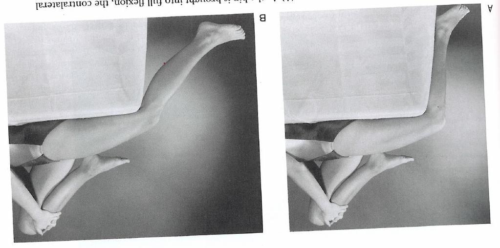 Exam: Special Tests Rectus Femoris Stretch Test Patient actively flexes the opposite hip to the chest while the leg behind examined is flexed at the knee over the edge of the exam table Positive test
