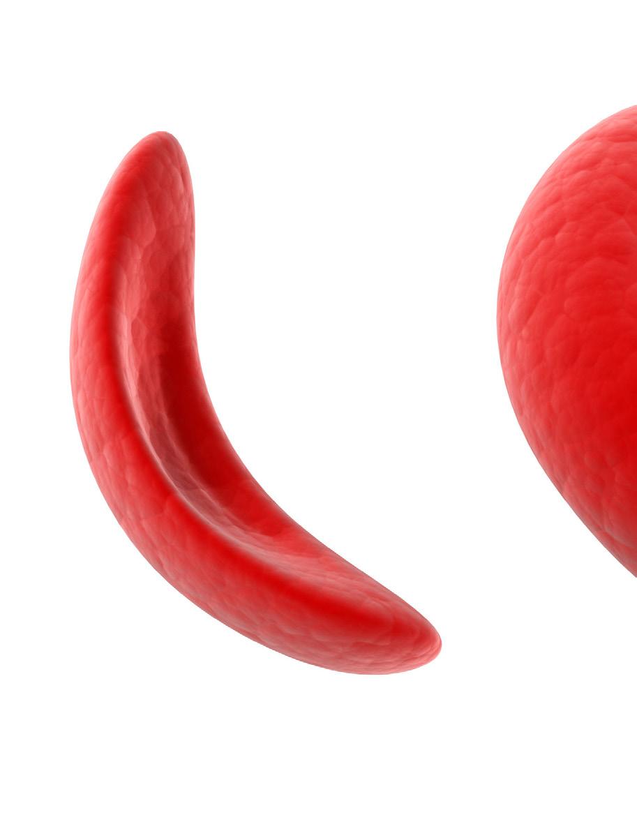 blood cells. These abnormal blood cells are called sickle cells.