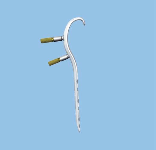 Surgical Technique 3 Insert guide wires Instruments 310.243 Guide Wire B 2.5 mm, with drill tip, length 200 mm, Stainless Steel 324.174 Wire Guide 5.0, for Guide Wire B 2.5 mm 324.175 Wire Guide 7.