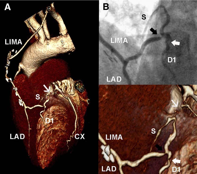 820 JACC: CARDIOVASCULAR IMAGING, VOL. 2, NO. 7, 2009 Table 3.
