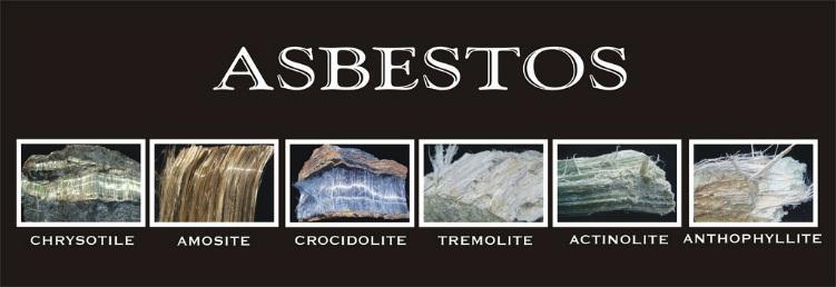 3. Asbestosis Asbestos is a heat-resistant fibrous silicate mineral that can be woven into fabrics, and is used in fireresistant and insulating materials such as brake linings.