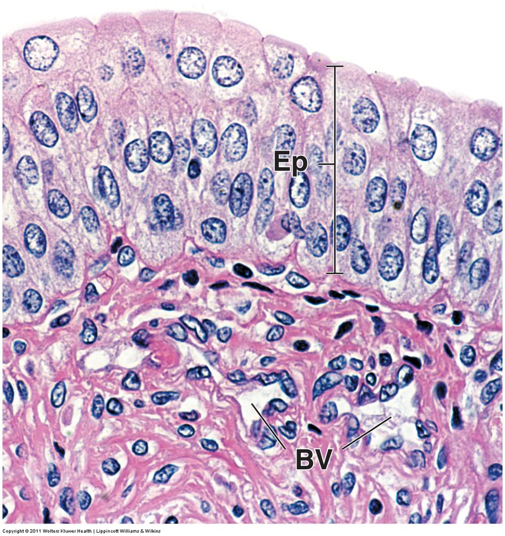 p.724 -- ureter, urinary bladder,urethra A. Mucosa Transitional epithelium (urothelium) -- dome-shaped cells -- surface cells: 1.