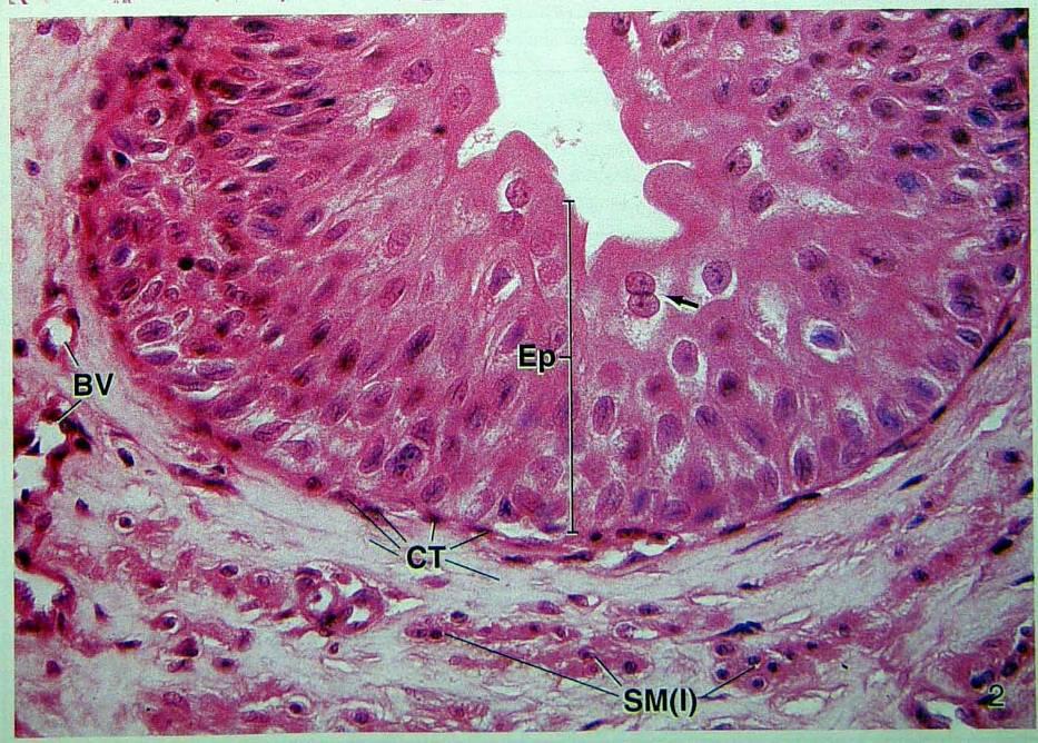 A. Mucosa -- Transitional epithelium