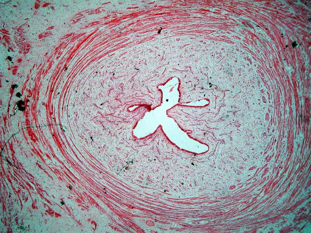 MH 1108 Female Urethra human H&E