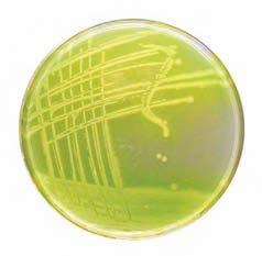 Harmonized Culture Media A comprehensive list of SRL harmonized media Tests for Specified Microorganisms Microorganism Product Code Product Name Bile-Tolerant 66070 Enterobacteria Enrichment Broth