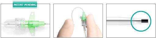 .., 2013; 60: 948 949 Luer socket hub for syringe Safe flow Integrated injection tube withluer Lock connection No clamping adapter required In the second step, the E-catheter is introduced in the