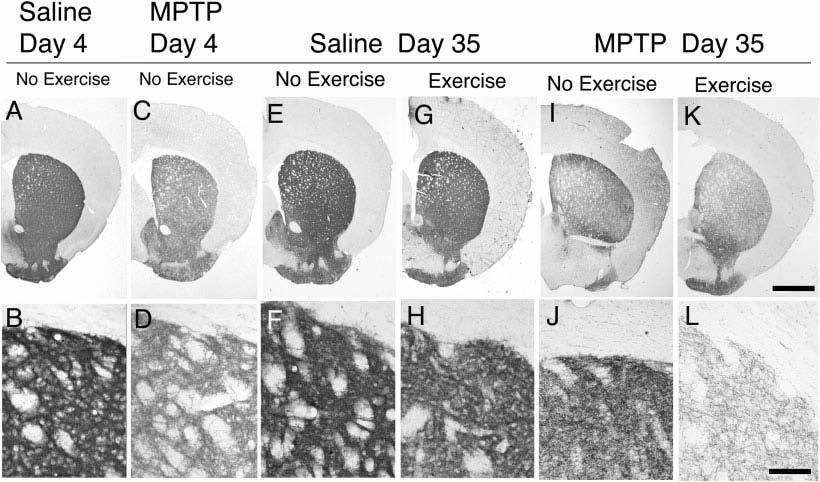 Exercise in the MPTP-Lesioned Mouse 383 Fig. 3. Exercise-induced changes in striatal dopamine transporter immunolabeling.