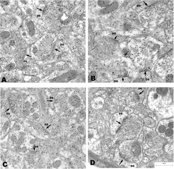386 Fisher et al. Fig. 7. Electron photomicrographs using the immunogold technique to localize an antibody against the neurotransmitter, glutamate, within the dorsolateral striatum. A: Saline group.