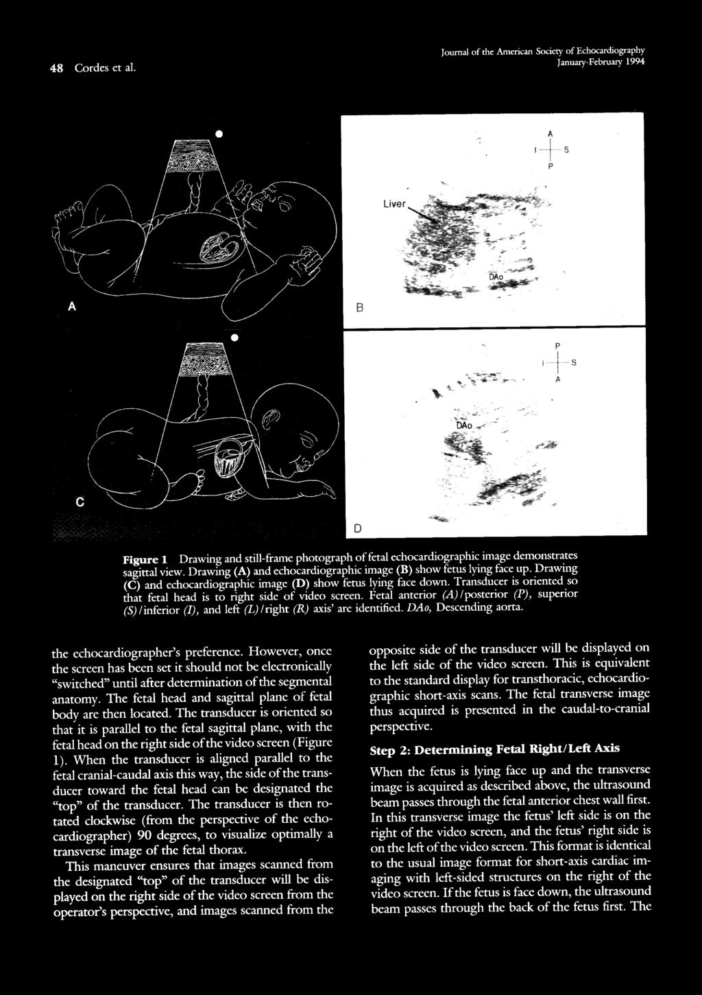 48 Cordes et a!. Journal of the American Society of Echocardiography January-February 1994 Figure 1 Drawing and still-frame photograph offetal echocardiographic image demonstrates sagittal view.